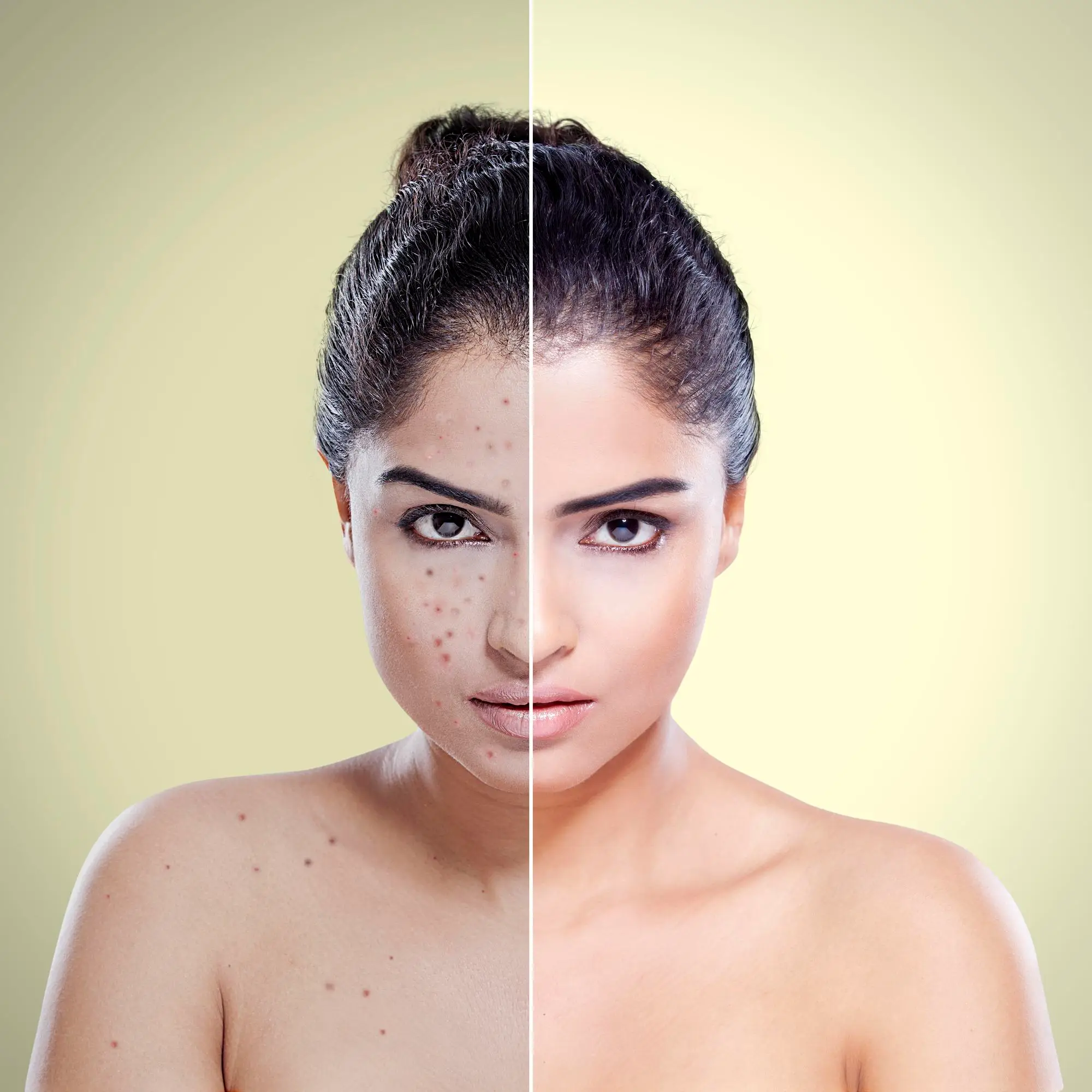 before-after before-after